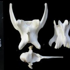 Vertebrae