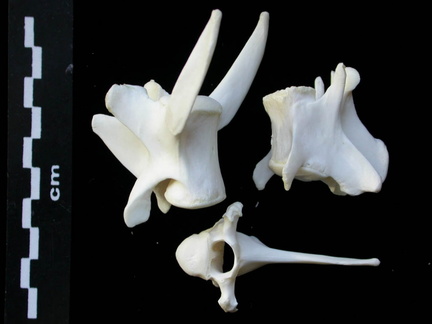 Vertebrae