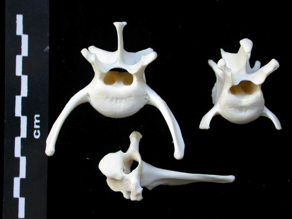 Vertebrae