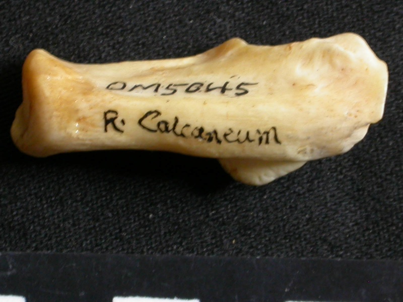 Calcaneus