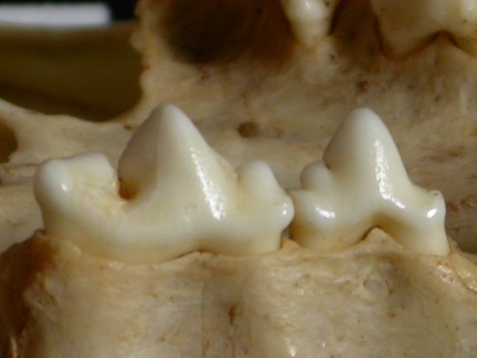 Dentition supérieure