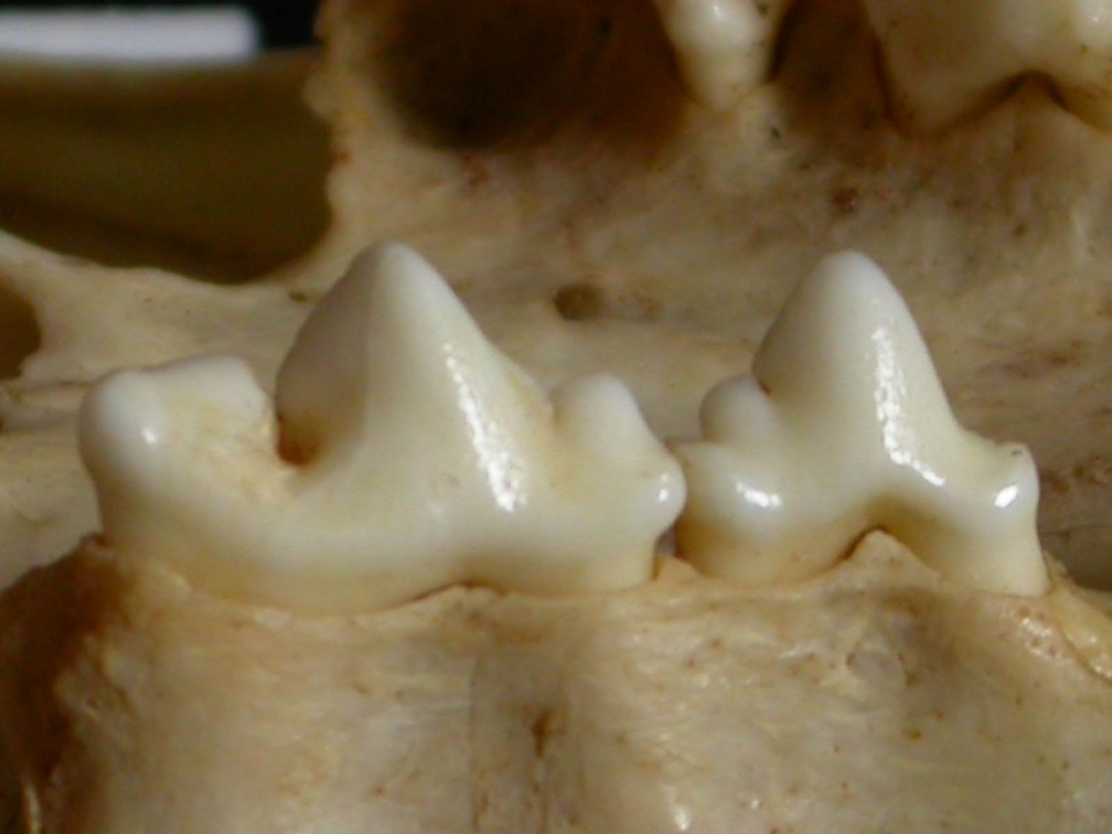 Dentition supérieure
