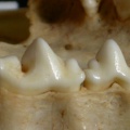 Dentition supérieure