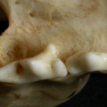 Dentition supérieure