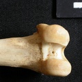 Femur: distal part