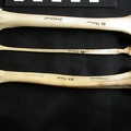  Femur, tibia and fibula