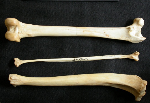  Femur, tibia and fibula