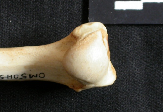 Humerus: proximale part