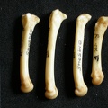 Metacarpals