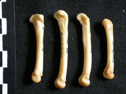 Metacarpals