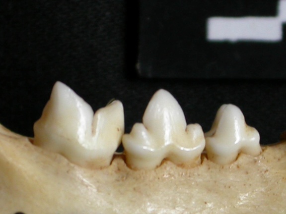 Lower teeth