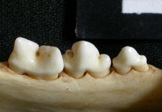 Lower teeth