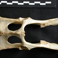 Pelvis