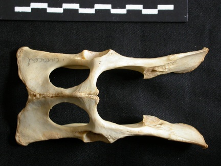 Pelvis