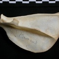 Scapula : vue latérale