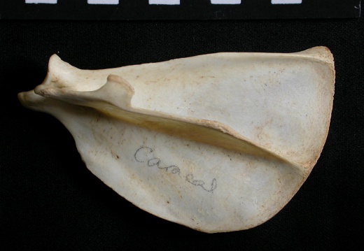 Scapula : vue latérale