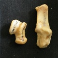 Talus and calcaneus