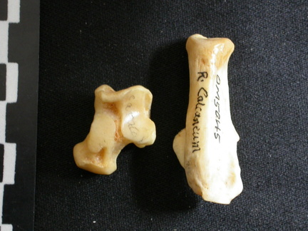 Talus et calcanéus