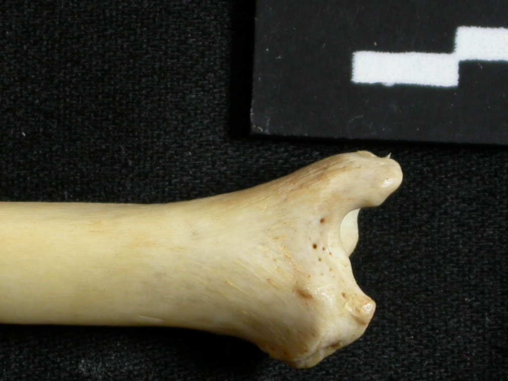  Tibia: distal part