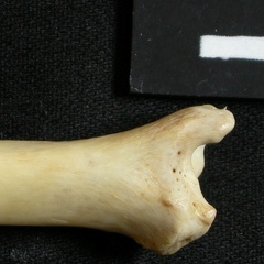 Tibia : partie distale (14387 visites) Tibia : partie distale
