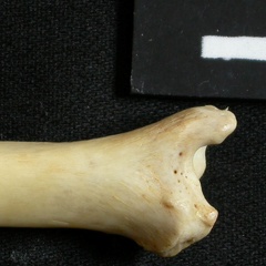  Tibia: distal part