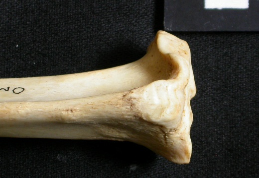  Tibia: proximale part