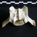 Cervical vertebra