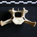 Cervical vertebra