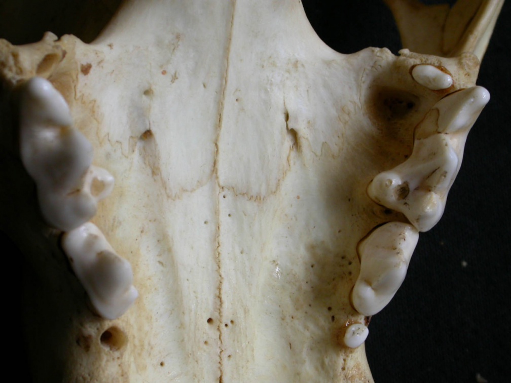 Dentition supérieure