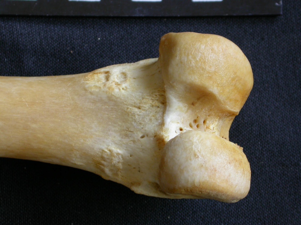 Femur: distal part