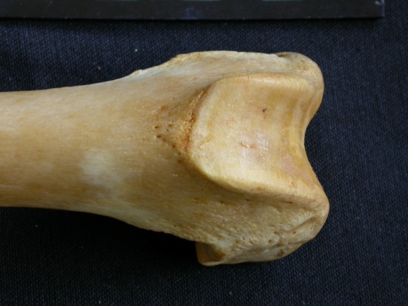 Femur: distal part