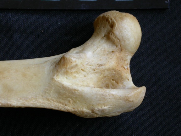 Femur: proximale part