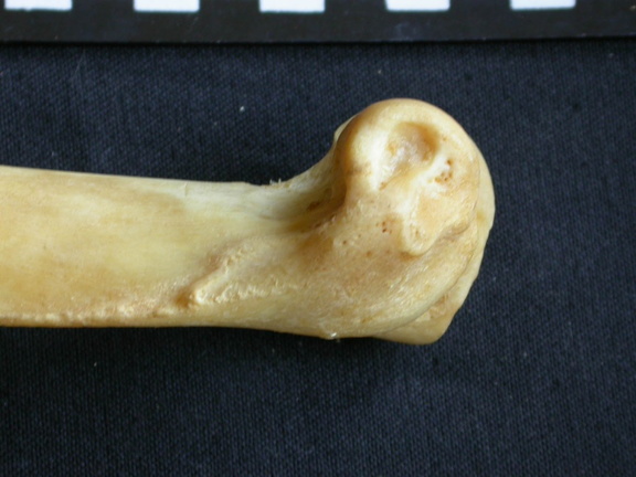 Humérus : partie distale