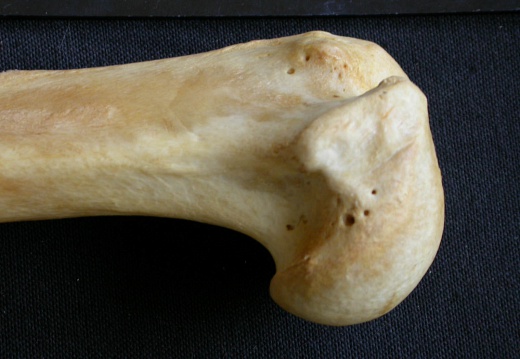 Humerus: proximale part