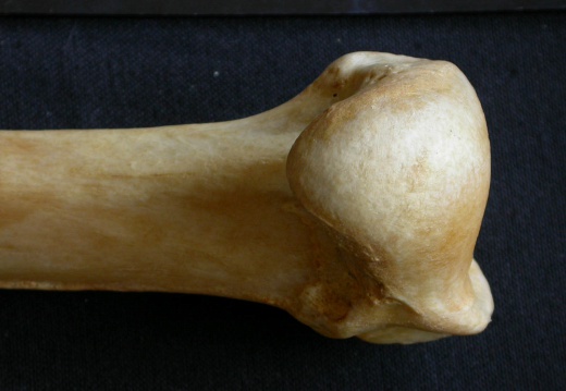 Humerus: proximale part