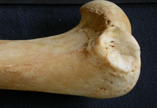 Humerus: proximale part