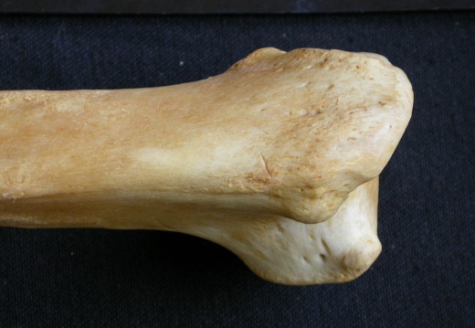 Humerus: proximale part