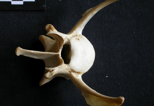 Lumbar vertebra