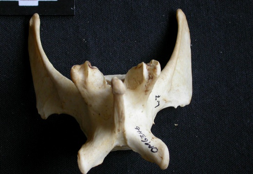 Lumbar vertebra