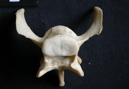 Lumbar vertebra