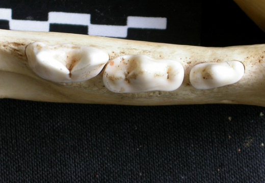 Lower teeth