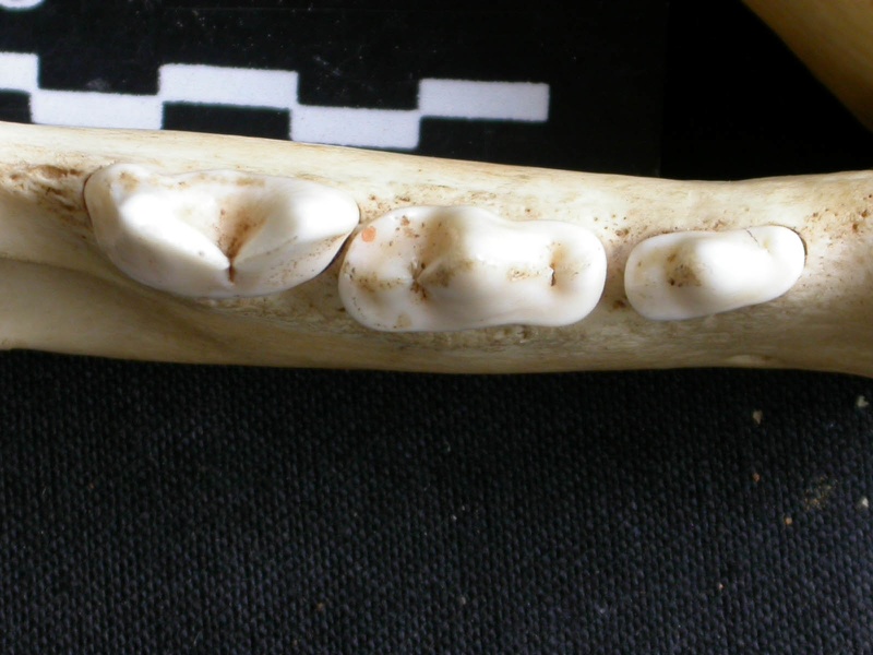 Dentition inférieure