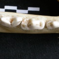 Dentition inférieure