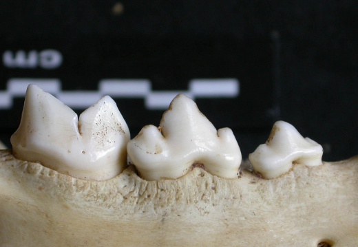 Lower teeth