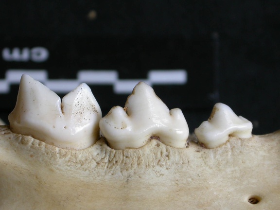 Lower teeth