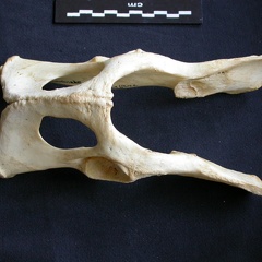 Pelvis