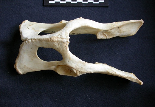 Pelvis