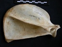 Scapula : vue latérale