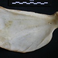 Scapula : vue médiale