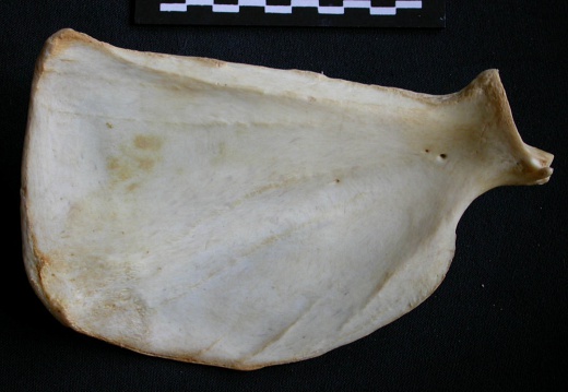 Scapula : vue médiale